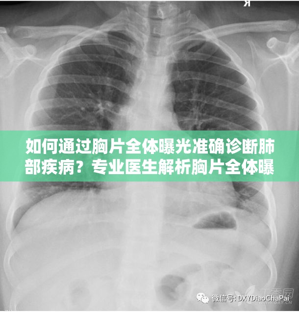 如何通过胸片全体曝光准确诊断肺部疾病？专业医生解析胸片全体曝光的关键步骤与注意事项